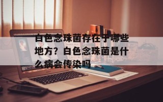白色念珠菌存在于哪些地方？白色念珠菌是什么病会传染吗